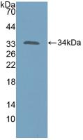 DAB staining on IHC-P; Samples: Human Kidney Tissue; Primary Ab: 10µg/ml Rabbit Anti-Human KATNA1 Antibody Second Ab: 2µg/mL HRP-Linked Caprine Anti-Rabbit IgG Polyclonal Antibody