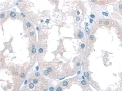 DAB staining on IHC-P; Samples: Human Liver Tissue.