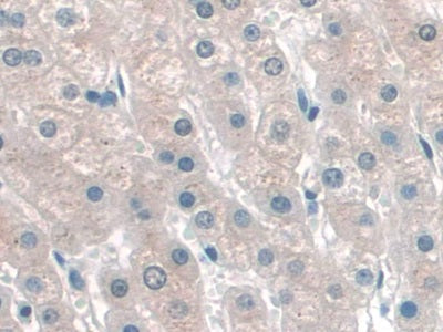 Katanin P60 Subunit A 1 (KATNA1) Polyclonal Antibody - image 5