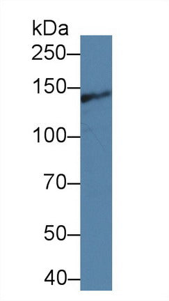 Western Blot; Sample: Recombinant protein.