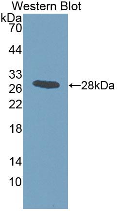 DAB staining on IHC-P; Samples: Rat Kidney Tissue; Primary Ab: 10µg/ml Rabbit Anti-Rat ITSN1 Antibody Second Ab: 2µg/mL HRP-Linked Caprine Anti-Rabbit IgG Polyclonal Antibody