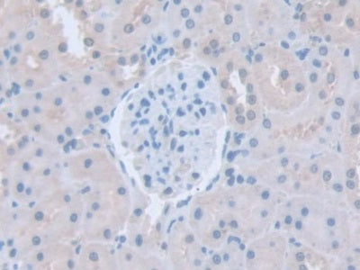 DAB staining on fromalin fixed paraffin- embedded Kidney tissue)