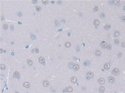Intersectin 1 (ITSN1) Polyclonal Antibody - image 5