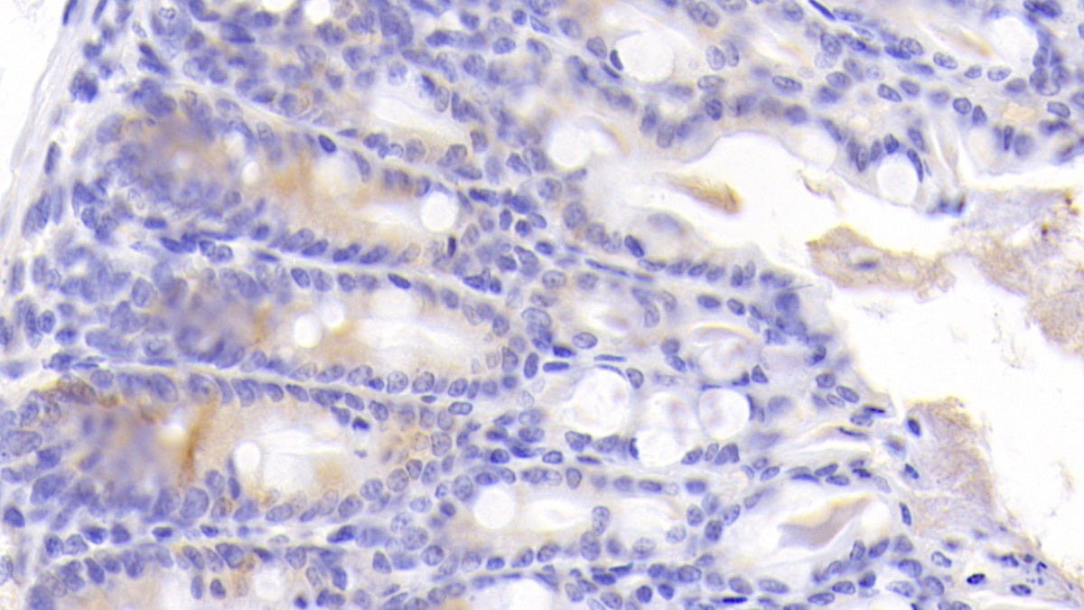 Intestinal Cell Kinase (ICK) Polyclonal Antibody - image 3