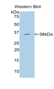 150 kDa Oxygen Regulated Protein (ORP150) Polyclonal Antibody - image 3