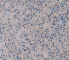 150 kDa Oxygen Regulated Protein (ORP150) Polyclonal Antibody - image 4