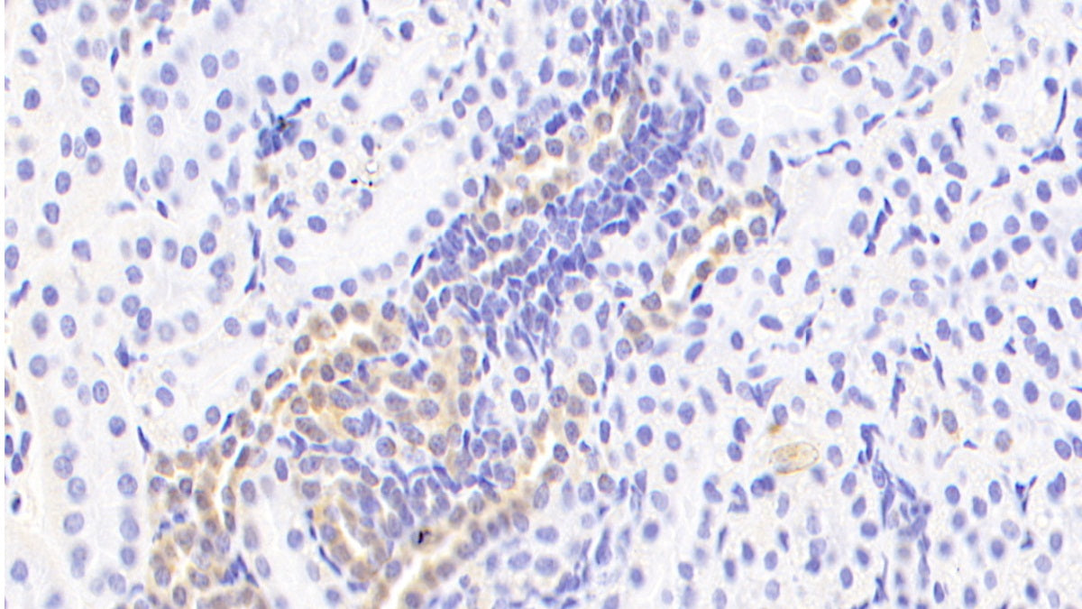 Homeodomain Only Protein (HOP) Polyclonal Antibody - image 4