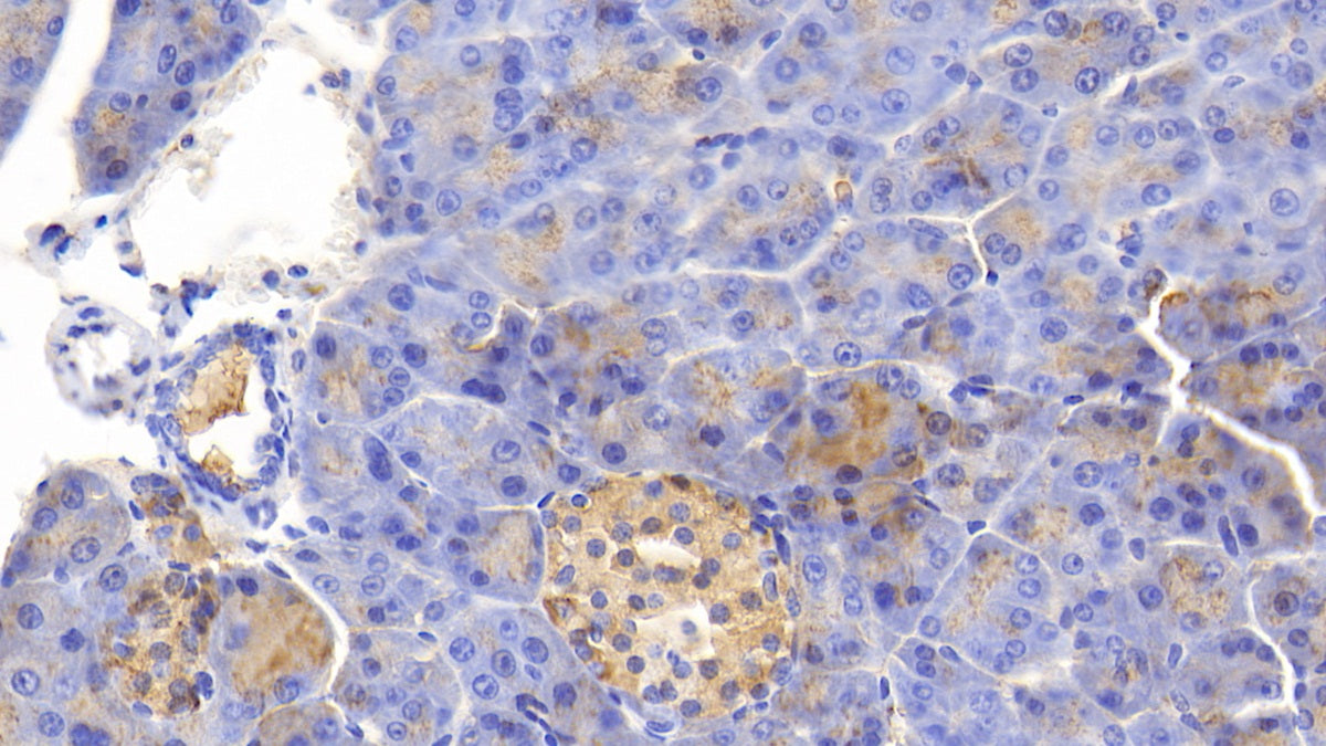 Gastrin Releasing Peptide Receptor (GRPR) Polyclonal Antibody - image 3