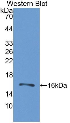 Gastrin Releasing Peptide Receptor (GRPR) Polyclonal Antibody - image 2