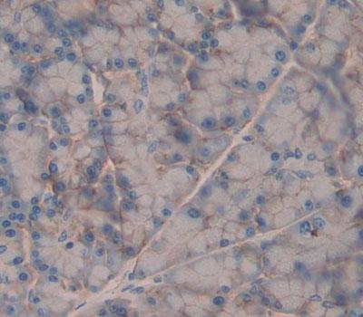 Gastrin Releasing Peptide Receptor (GRPR) Polyclonal Antibody - image 3