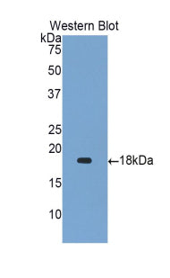 Gastrokine 1 (GKN1) Polyclonal Antibody - image 3