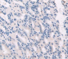 Gastrokine 1 (GKN1) Polyclonal Antibody - image 4