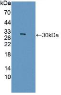 DAB staining on IHC-P; Samples: Rat Kidney Tissue; Primary Ab: 20µg/ml Rabbit Anti-Rat GAMT Antibody Second Ab: 2µg/mL HRP-Linked Caprine Anti-Rabbit IgG Polyclonal Antibody