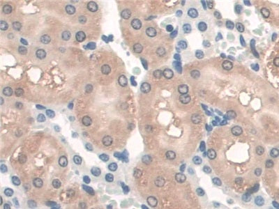 DAB staining on IHC-P; Samples: Rat Heart Tissue.