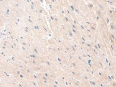 Guanidinoacetate-N-Methyltransferase (GAMT) Polyclonal Antibody - image 5