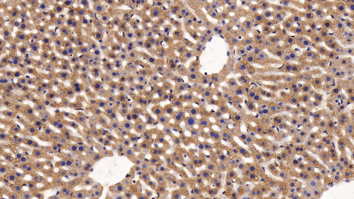 Furin (FUR) Polyclonal Antibody - image 5