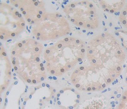 Fibrillarin (FBL) Polyclonal Antibody - image 3