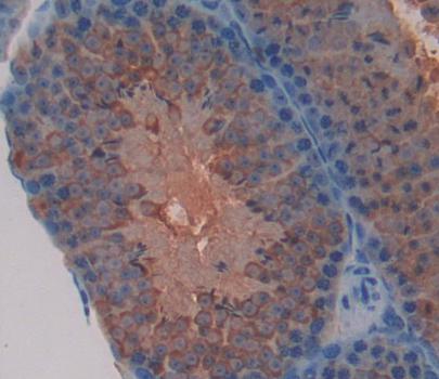 Follicular Lymphoma Variant Translocation 1 (FVT1) Polyclonal Antibody - image 3
