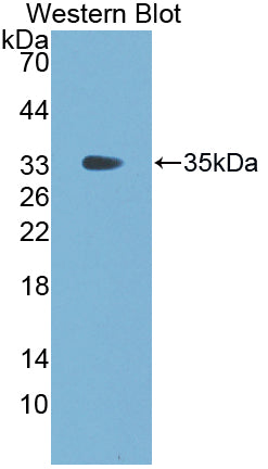 Fibrinogen Gamma (FGg) Polyclonal Antibody - image 3