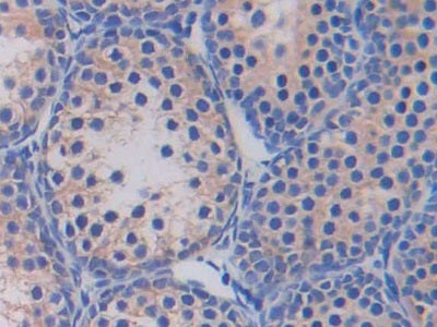 DAB staining on fromalin fixed paraffin- embedded testis tissue)