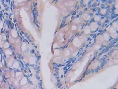 Fatty Acid Synthase (FASN) Polyclonal Antibody - image 4