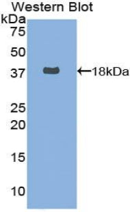 Fatty Acid Synthase (FASN) Polyclonal Antibody - image 2