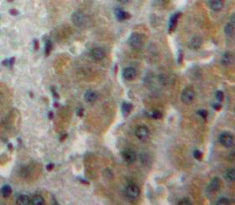 Fatty Acid Synthase (FASN) Polyclonal Antibody - image 3