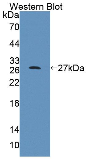 Cytosolic Ovarian Carcinoma Antigen 1 (COVA1) Polyclonal Antibody - image 2