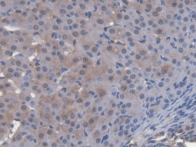 DAB staining on fromalin fixed paraffin- embedded kidney tissue)