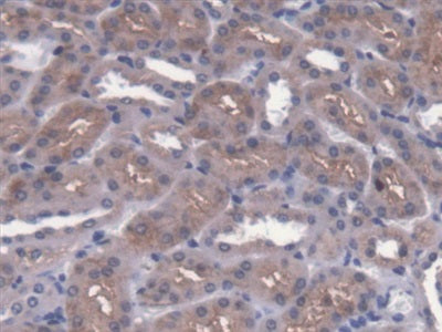 Cytosolic Ovarian Carcinoma Antigen 1 (COVA1) Polyclonal Antibody - image 4