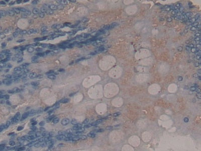 DAB staining on fromalin fixed paraffin- embedded Kidney tissue)