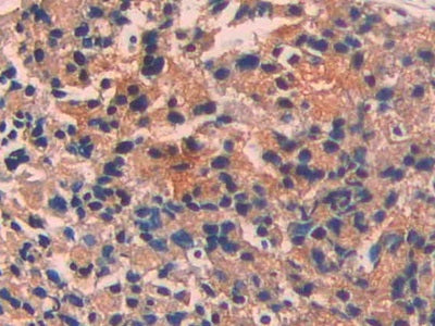 DAB staining on fromalin fixed paraffin- embedded kidney tissue)