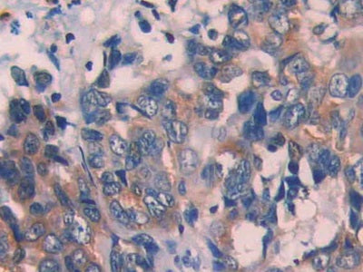 Epithelial Cell Transforming Sequence 2 (ECT2) Polyclonal Antibody - image 4