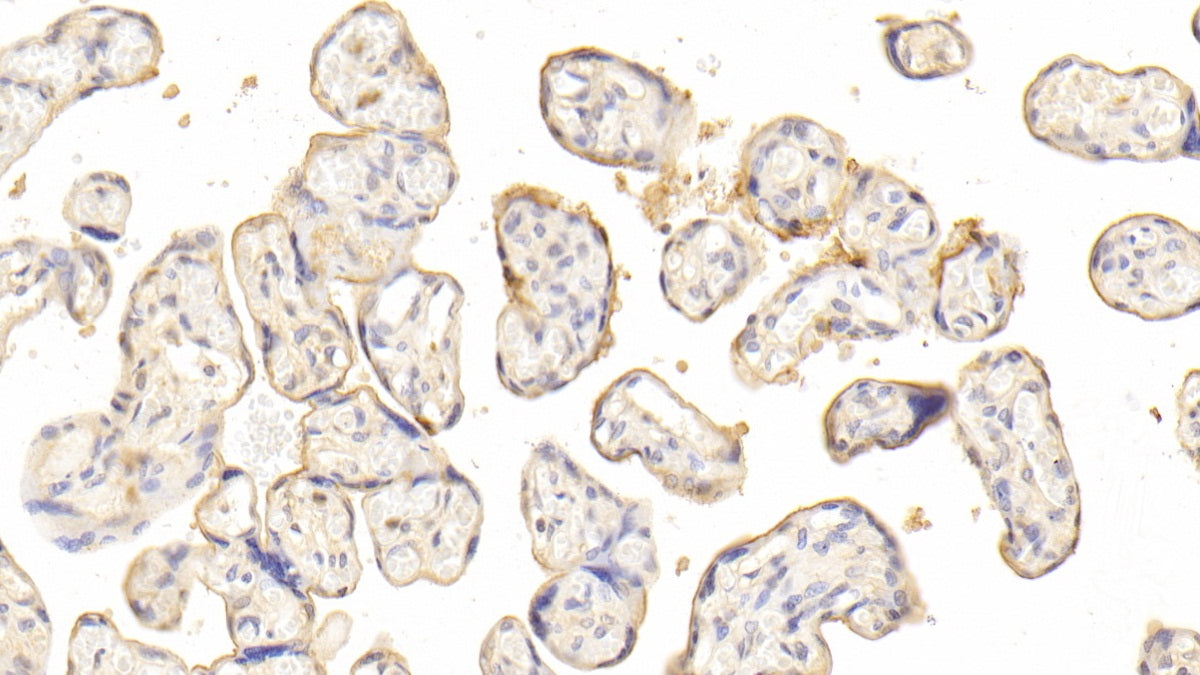 DABstainingonIHC-P.Samples:HumanTissue)