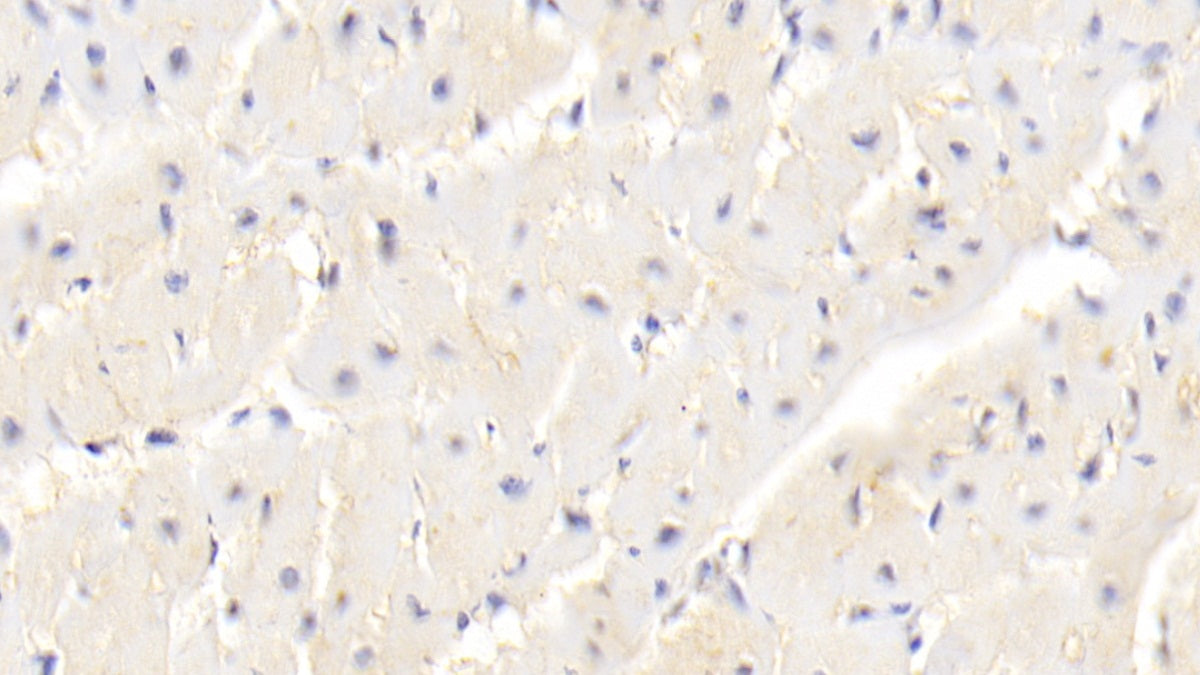 Dysferlin (DYSF) Polyclonal Antibody - image 4