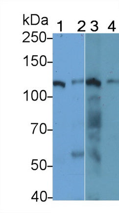 DAB staining on IHC-P; Samples: Human Skeletal muscle Tissue; Primary Ab: 20μg/ml Rabbit Anti-Human DAAM1 Antibody Second Ab: 2µg/mL HRP-Linked Caprine Anti-Rabbit IgG Polyclonal Antibody