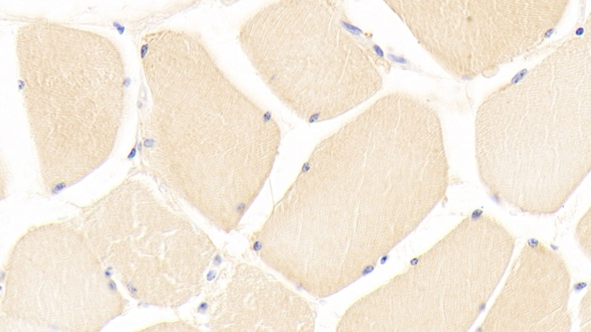 DAB staining on fromalin fixed paraffin- embedded liver tissue)
