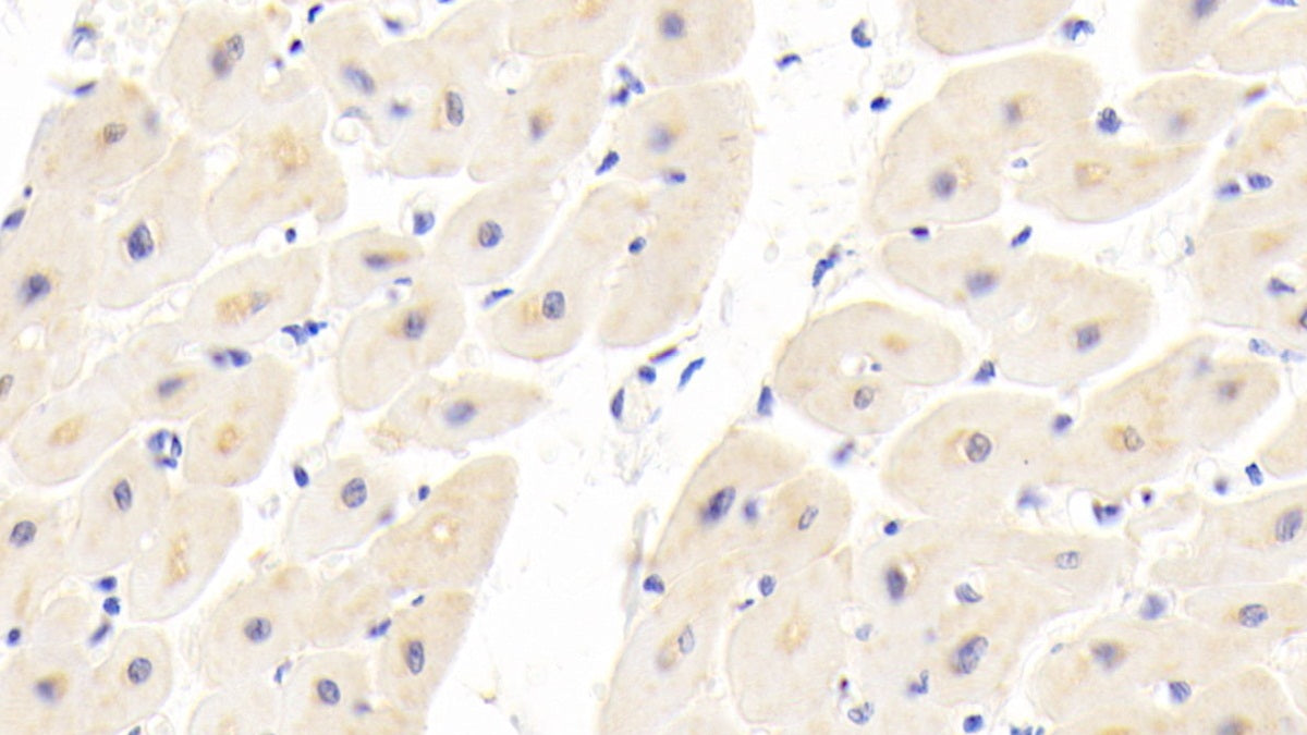 Dishevelled Associated Activator Of Morphogenesis 1 (DAAM1) Polyclonal Antibody - image 5