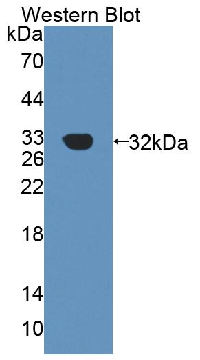 Constitutive Androstane Receptor (CAR) Polyclonal Antibody - image 2