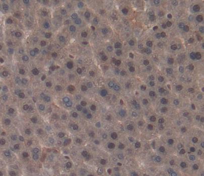 Constitutive Androstane Receptor (CAR) Polyclonal Antibody - image 3