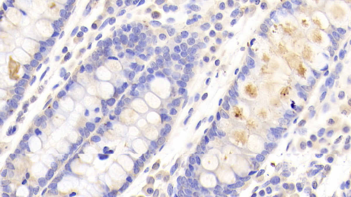 Chimerin 2 (CHN2) Polyclonal Antibody - image 3