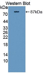 Carnitine Palmitoyltransferase 2, Mitochondrial (CPT2) Polyclonal Antibody - image 2