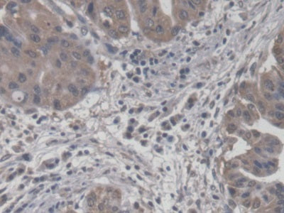 DAB staining on fromalin fixed paraffin- embedded Kidney tissue)