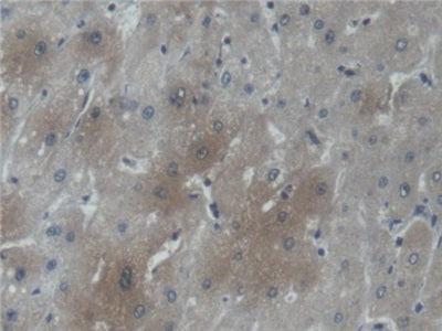 Carnitine-O-Octanoyltransferase (CORT) Polyclonal Antibody - image 4
