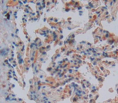 Cysteine Rich Protein 1, Intestinal (CRIP1) Polyclonal Antibody - image 3
