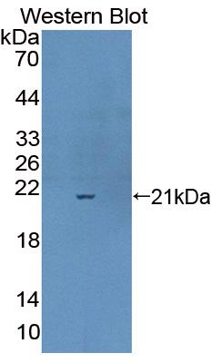 DAB staining on IHC-P; Samples: Human Cerebrum Tissue;  Primary Ab: 10µg/ml Rabbit Anti-Human CPLX1 Antibody Second Ab: 2µg/mL HRP-Linked Caprine Anti-Rabbit IgG Polyclonal Antibody