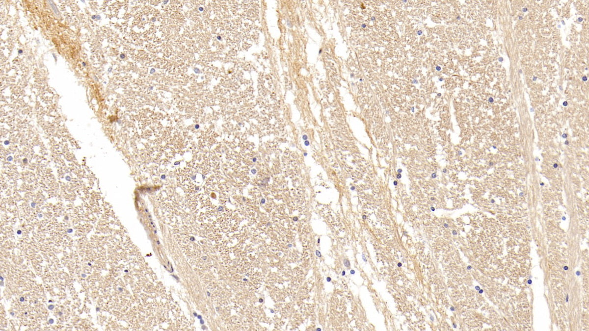 Complexin 1 (CPLX1) Polyclonal Antibody - image 4