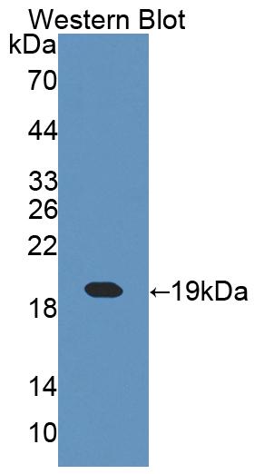Cellular Retinoic Acid Binding Protein 1 (CRABP1) Polyclonal Antibody - image 2