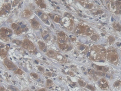 DAB staining on fromalin fixed paraffin- embedded brain tissue)