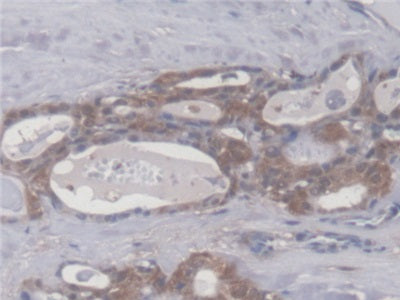 Cellular Retinoic Acid Binding Protein 1 (CRABP1) Polyclonal Antibody - image 4